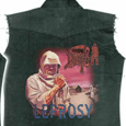 Death : Leprosy